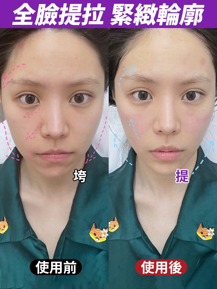 反重力提拉V臉面雕