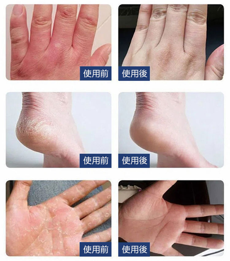 長效保濕防乾裂防凍膏