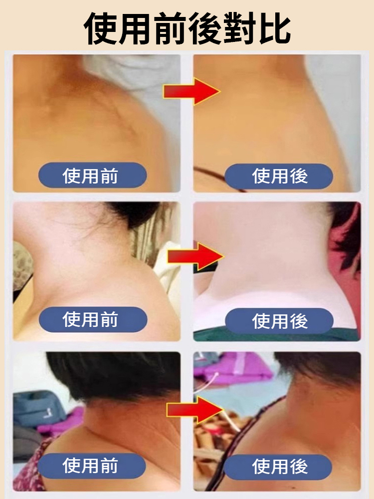 草本滲透溫熱金骨膏