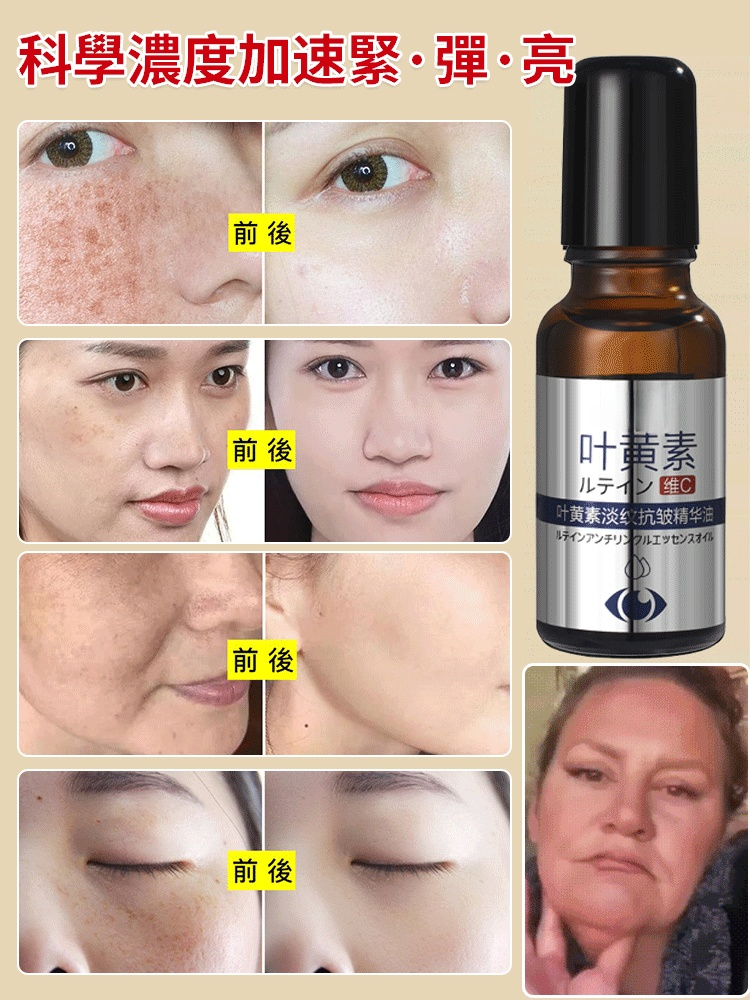 葉黃素淡紋抗皺精華油