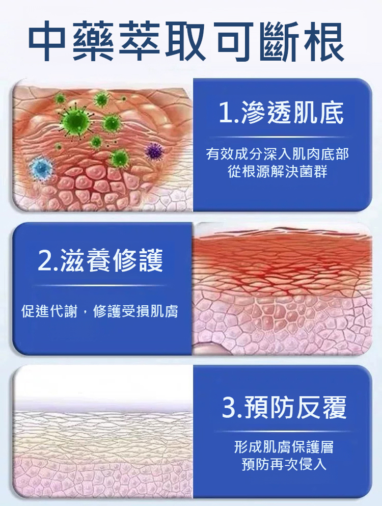 雲南本草本舒癢乳膏