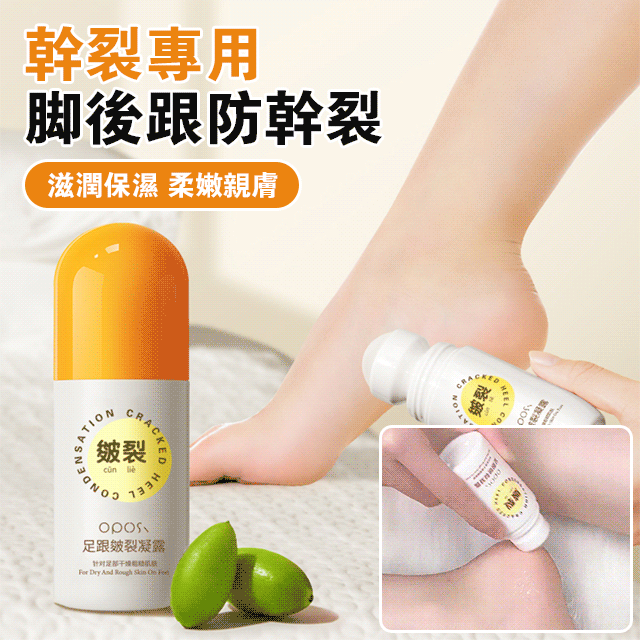足跟皴裂凝露