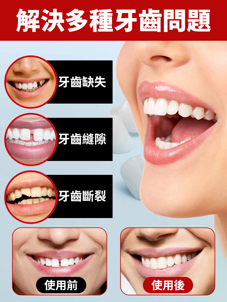 可塑修飾牙齒固體膠
