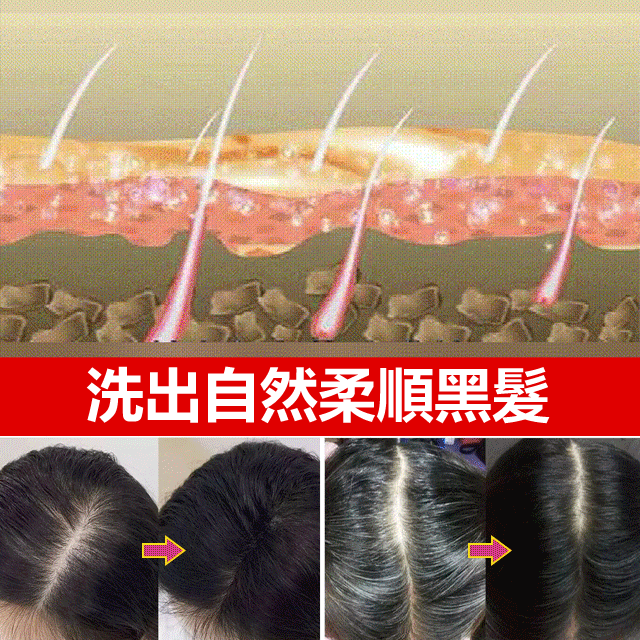 黑靈芝何首烏髮根洗髮水