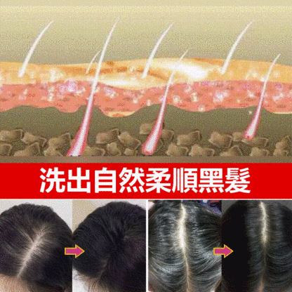 黑靈芝何首烏髮根洗髮水