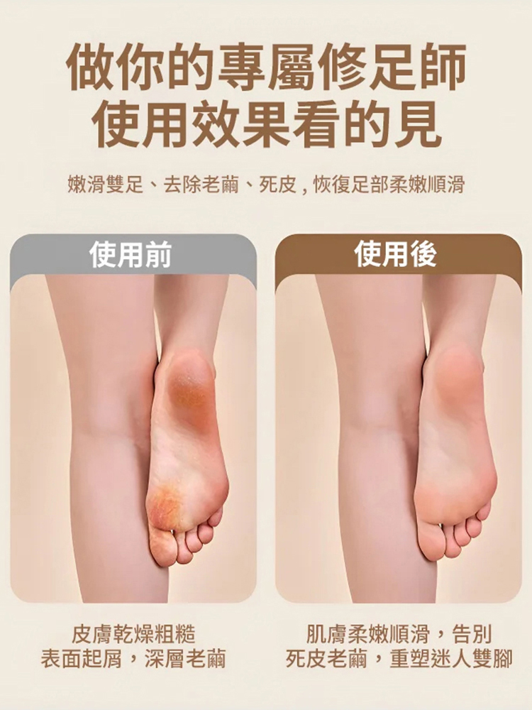 去死皮老繭新款電動磨腳器