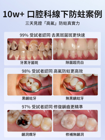 益口寧口腔防蛀牙膏