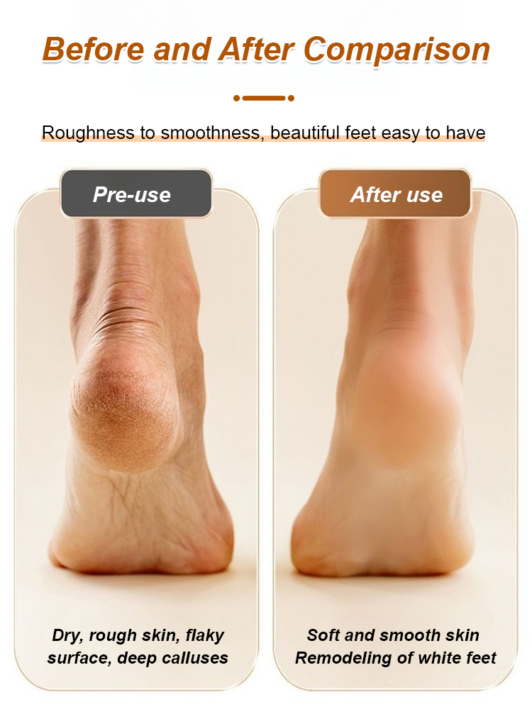 Gentle, non-abrasive, multi-functional foot scrubber✅Perfectly fits the skin✅Even gaps can be easily polished.