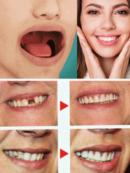 🦷Perfect dentures, Just like your real teeth, you can eat it anytime, hot, cold, sour or sweet.