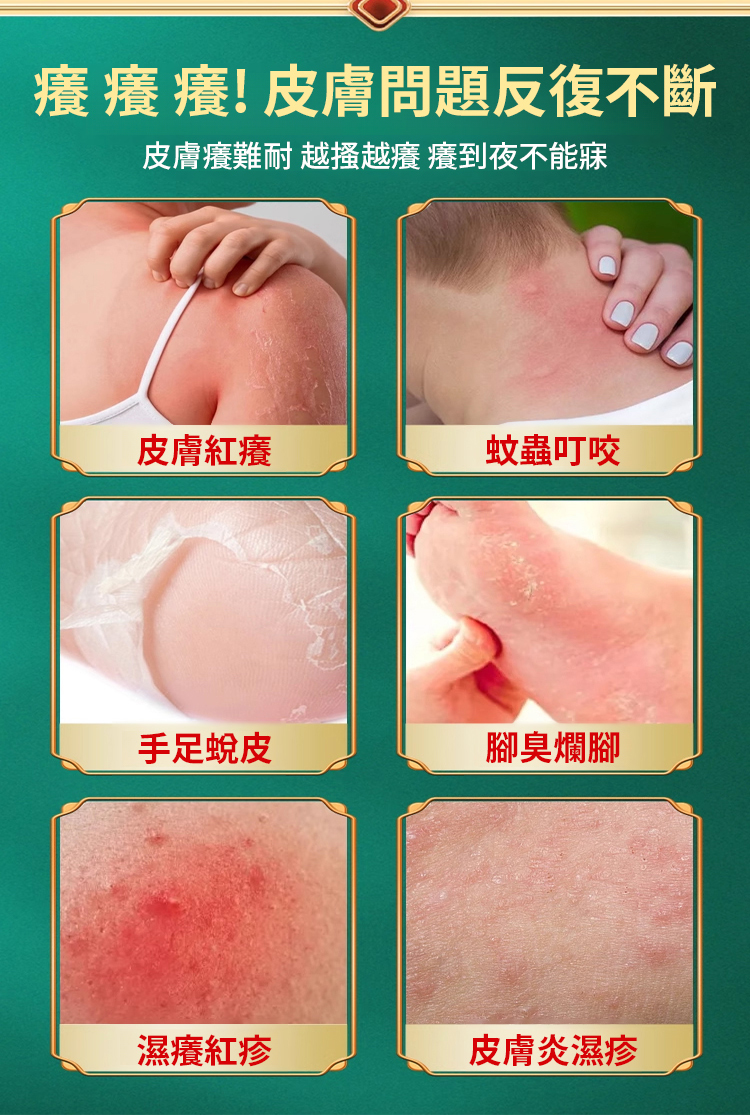 苗家祖大夫抑菌乳膏 苗家祖大夫抑菌乳膏