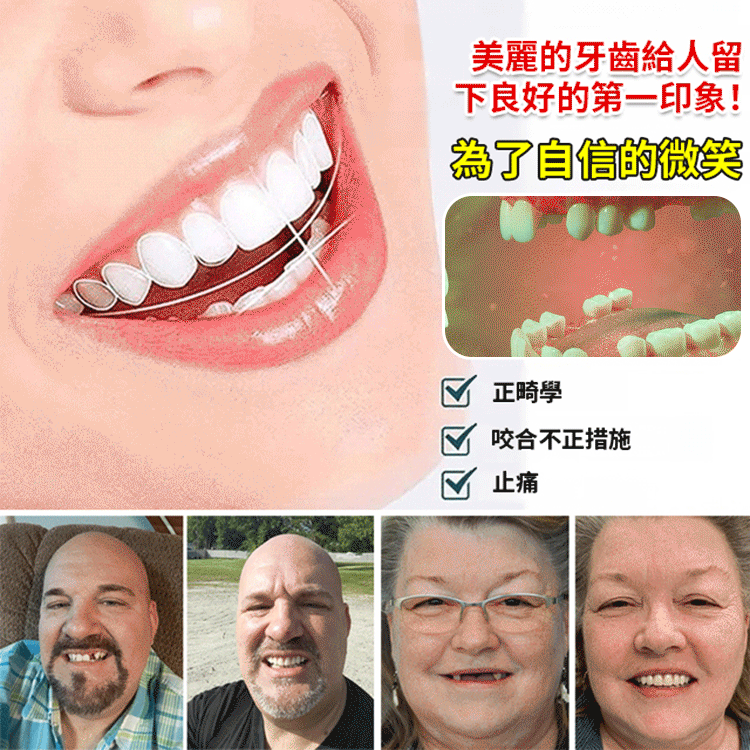 ORALHOE假牙修飾組（送牙膠）