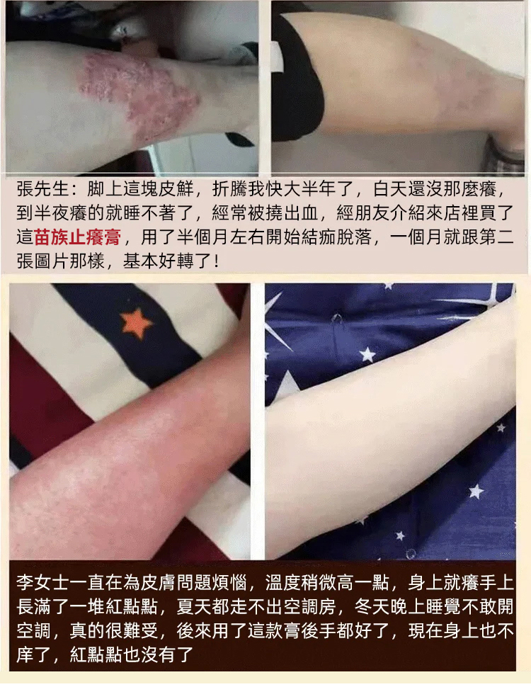 苗家祖大夫抑菌乳膏 苗家祖大夫抑菌乳膏