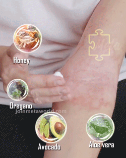 苗家祖大夫抑菌乳膏 苗家祖大夫抑菌乳膏