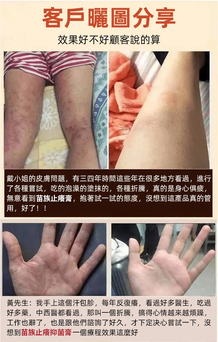 苗家祖大夫抑菌乳膏 苗家祖大夫抑菌乳膏