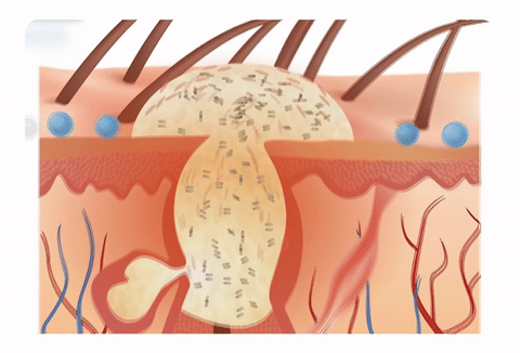 苗家祖大夫抑菌乳膏 苗家祖大夫抑菌乳膏