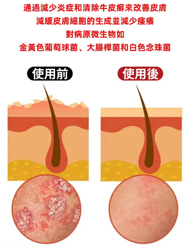 苗家祖大夫抑菌乳膏 苗家祖大夫抑菌乳膏