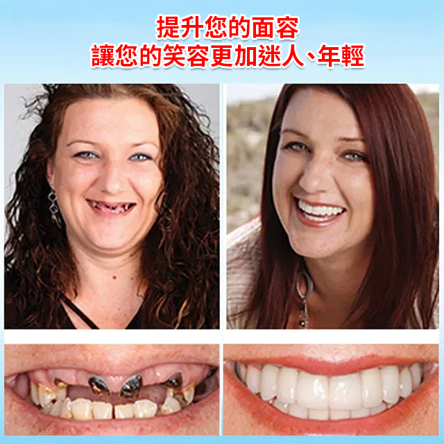 ORALHOE假牙修飾組（送牙膠）