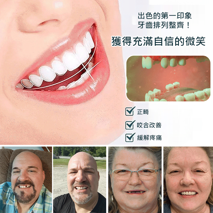 完美微笑假牙套裝
