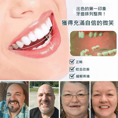 完美微笑假牙套裝