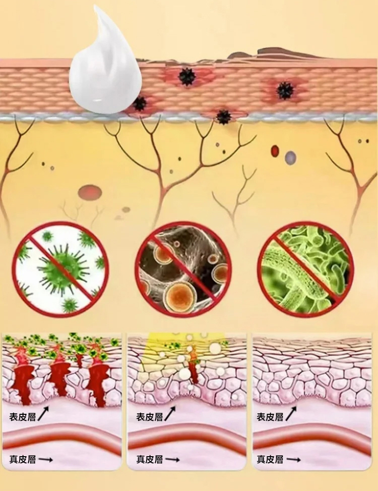 苗家祖大夫抑菌乳膏 苗家祖大夫抑菌乳膏