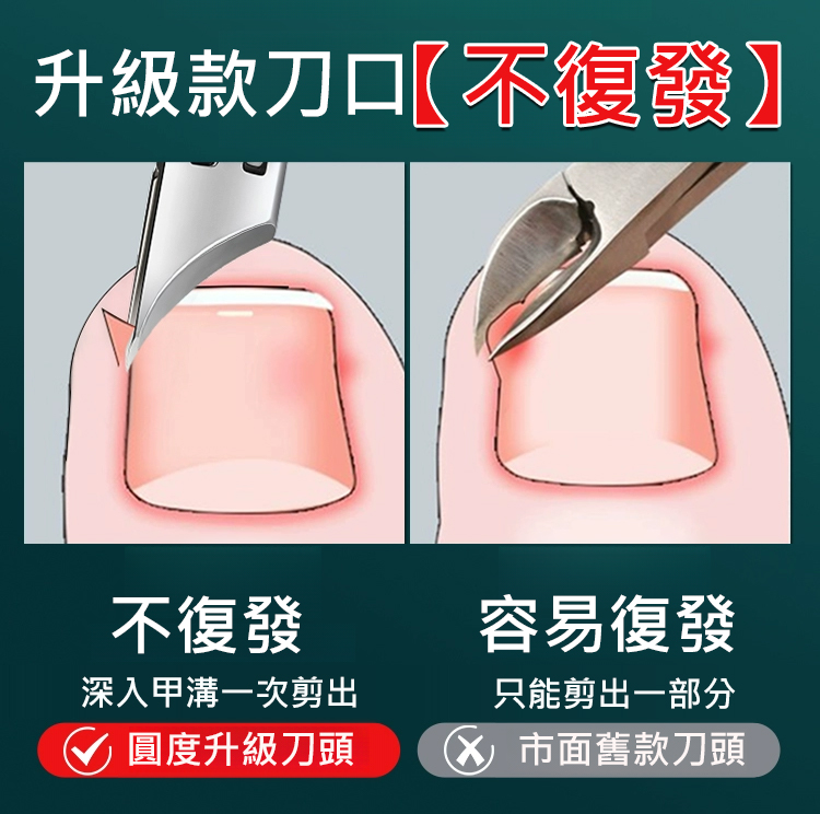 甲溝炎專用斜口指甲剪套裝