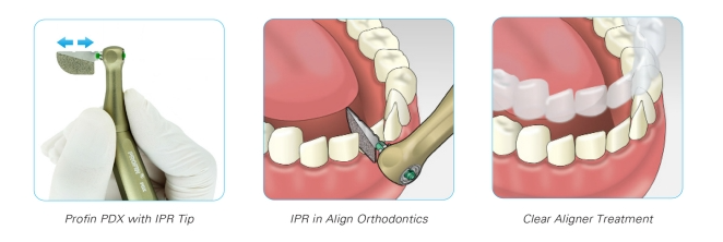 Profin for Orthodontists
