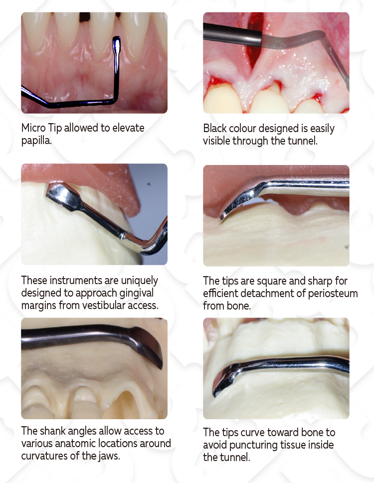 VISTA elevator set image 3