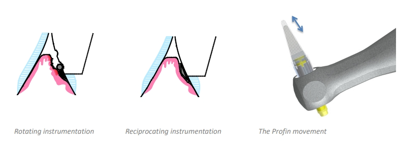 Profin for Prosthodontics