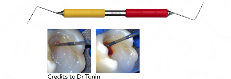 MisurEndo instrument