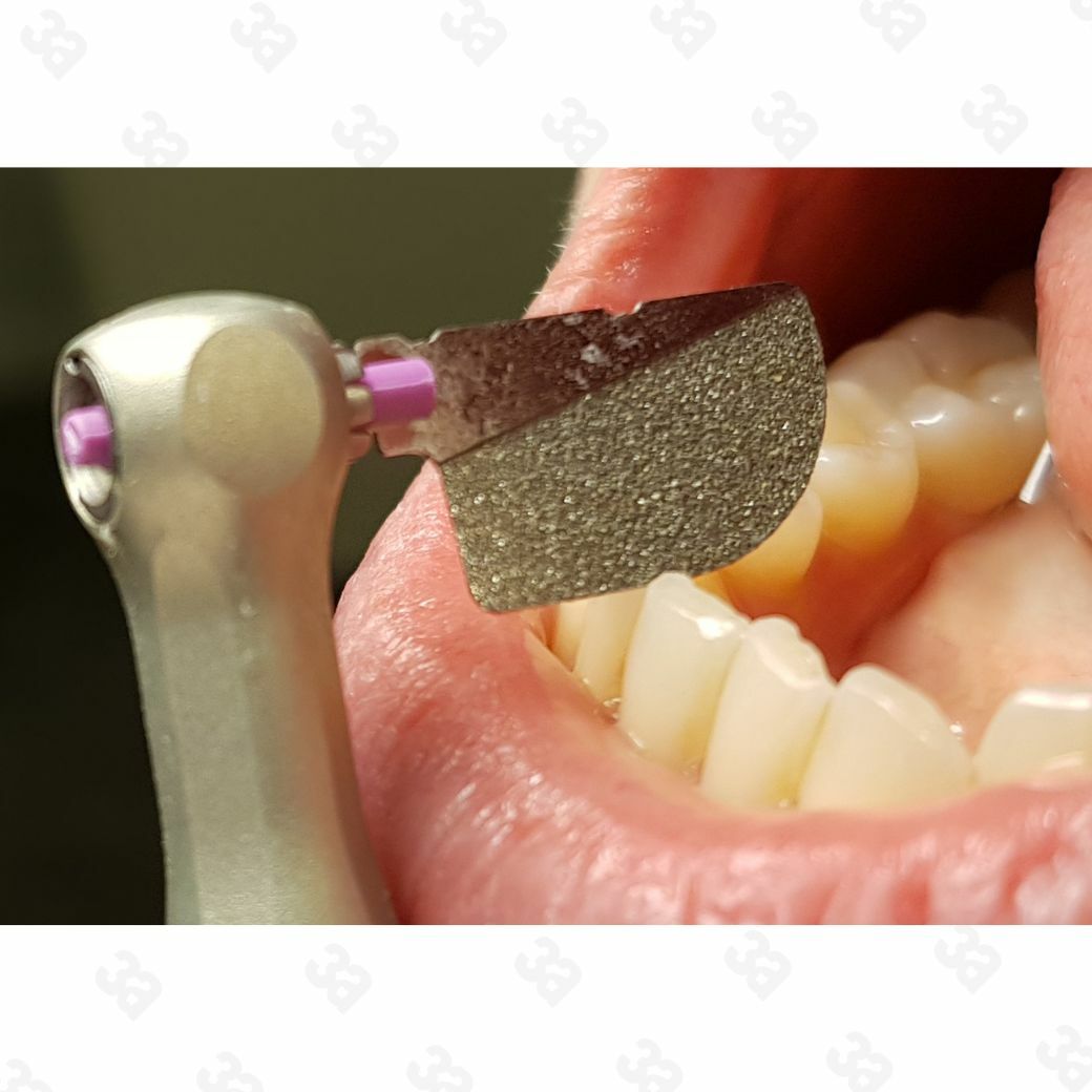 5 Lamineer Tips for IPR