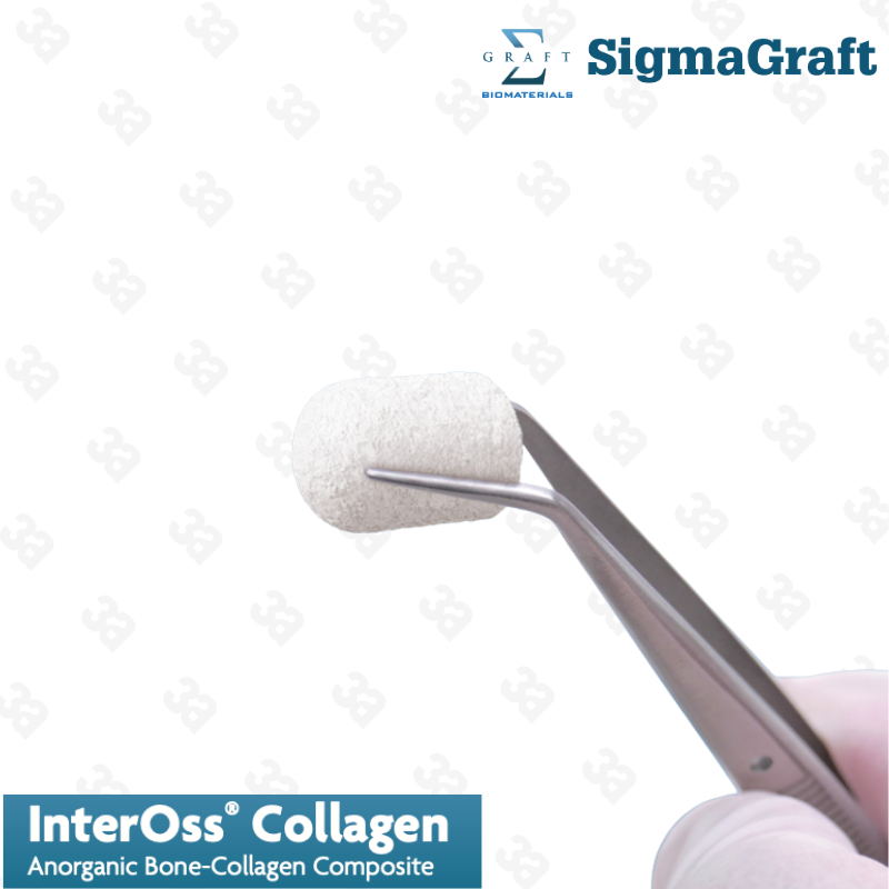 InterOss Collagen Plug Anorganic Bone-collagen Composite