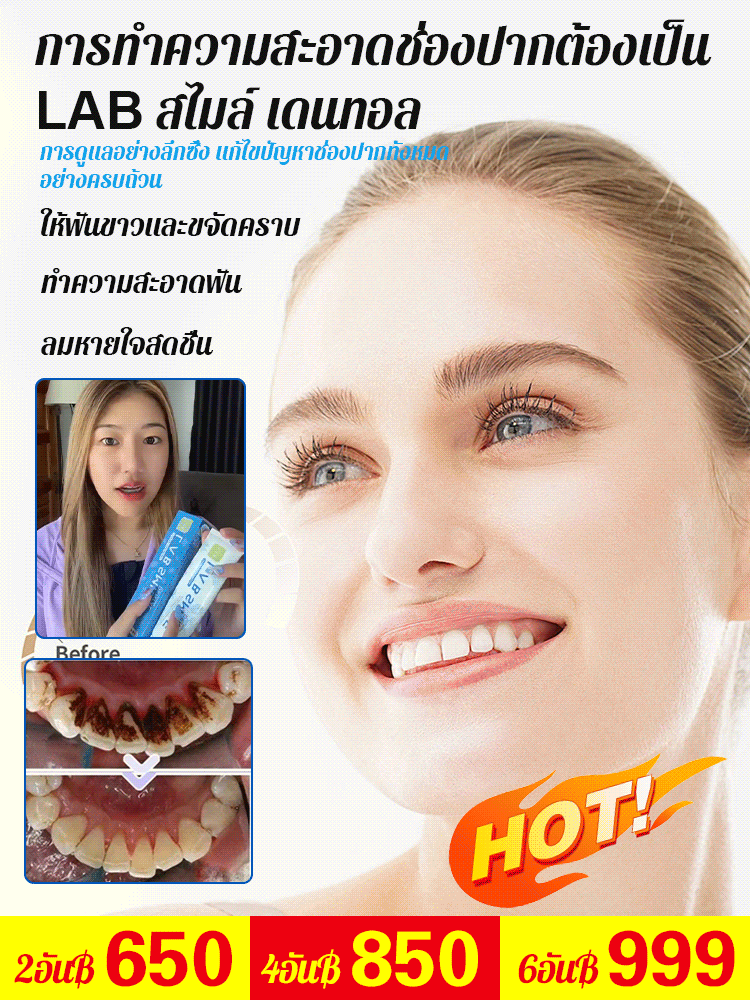 GK-[ให้คุณมีฟันสวย] ยาสีฟันที่หมอฟันก็ใช้