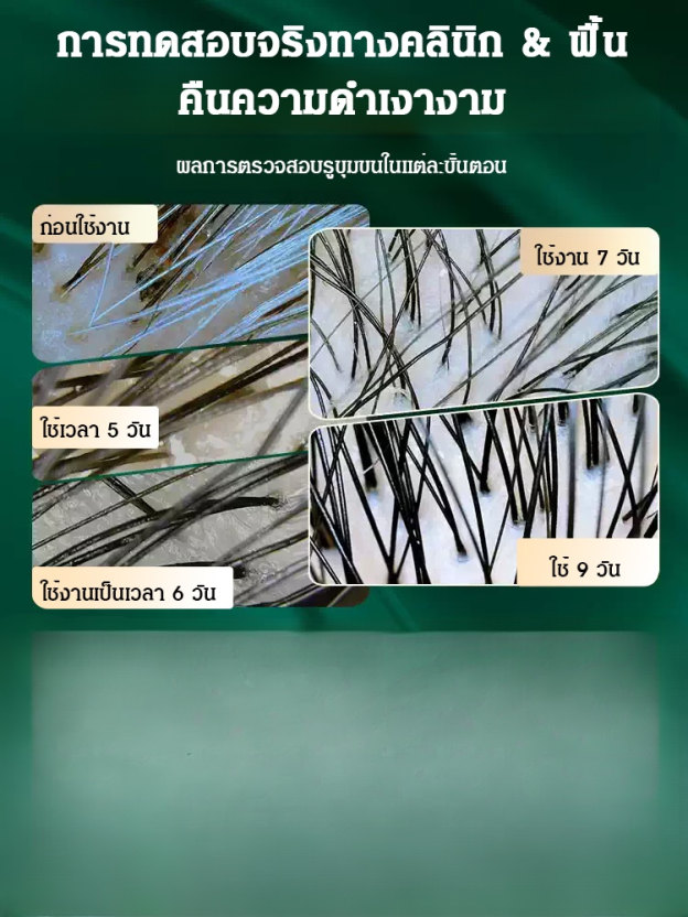 【ไวท์แฮร์ แคร์ แบล็ค】สเปรย์น้ำมันบำรุงผม