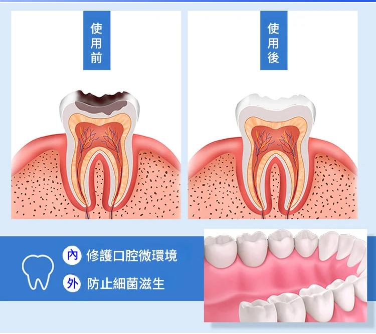 雲南本草牙痛寧噴劑