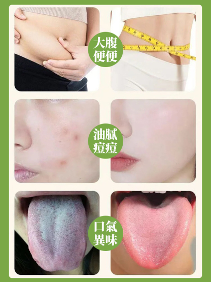 燃燃炫腹噗噗艾草貼