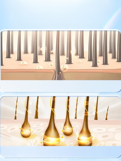 頭皮祛痘止癢毛囊膏