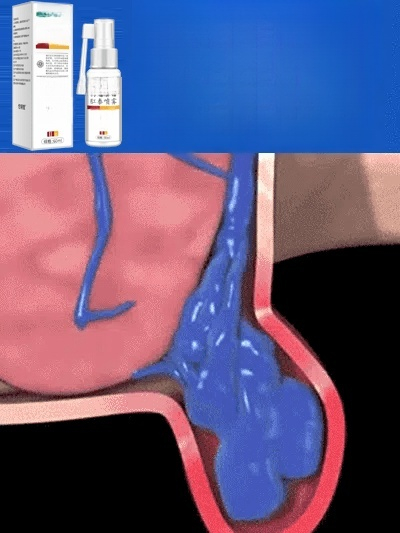 雲南本草黃連麝香肛泰噴霧