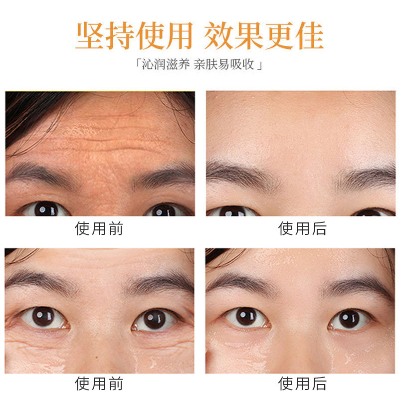 💯Original Ready Stocks Swisscorr Apple Stem Cell Dr Appers苹果干细胞 Dr.Appers Stemcell Essence