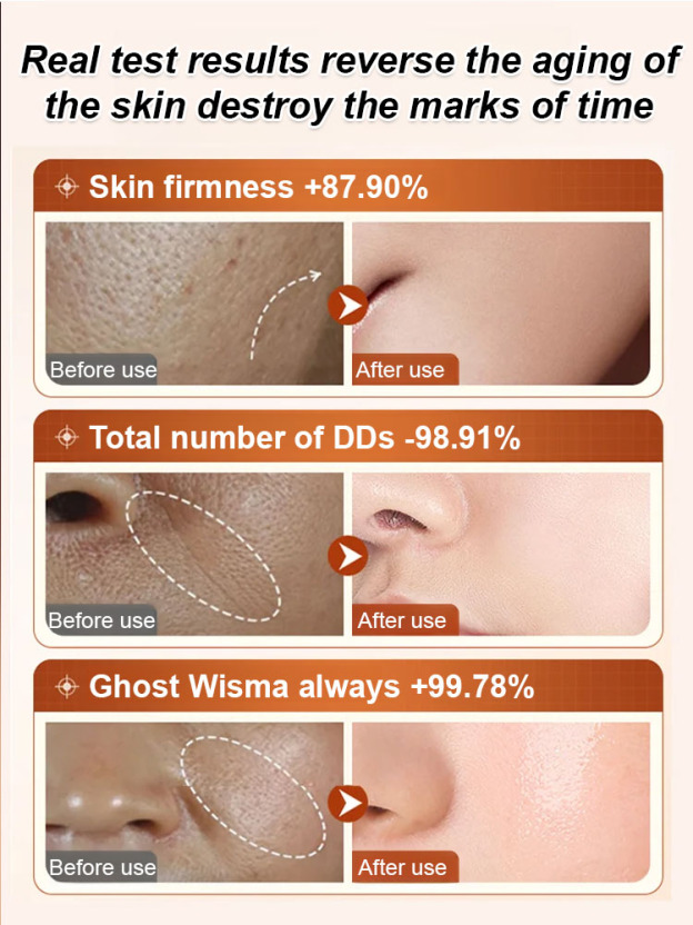 【✅✅✅Bestselling in beauty salons, 100,000+ bottles sold】 Firms skin in 14 days, reduces wrinkles and rejuvenates, plant-based formula, gentle and non-irritating