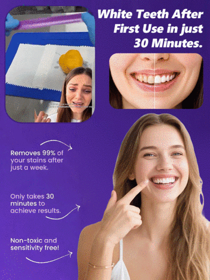 【At-Home Dental Whitening】Stop Hiding Your Smile – Get the 'Pearly White' Confidence You Deserve! 💎✨