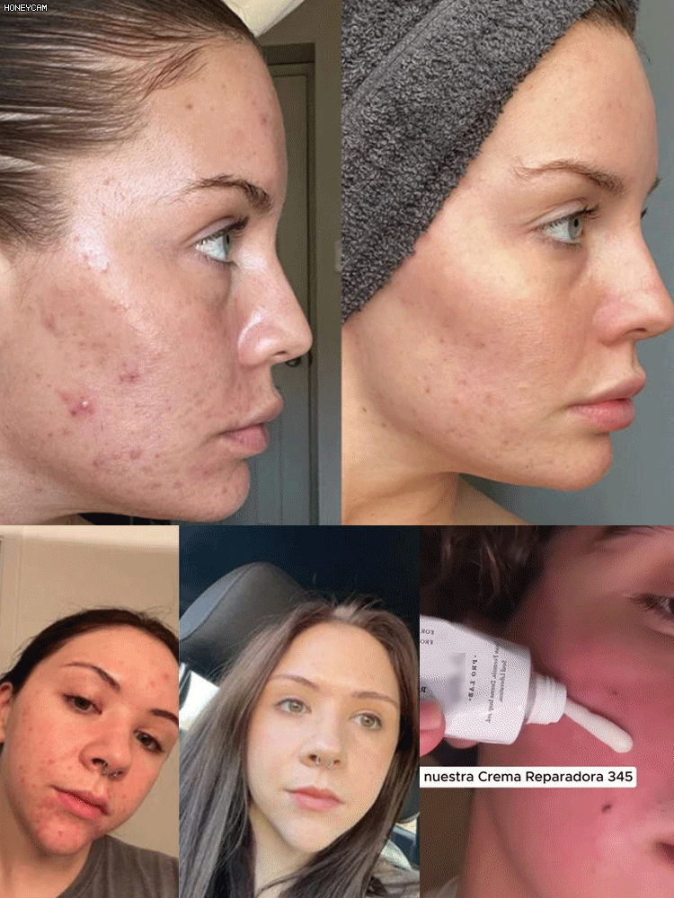  Hydrating and Nourishing Face Cream 345 💎Fades Spots. Restores Glow.