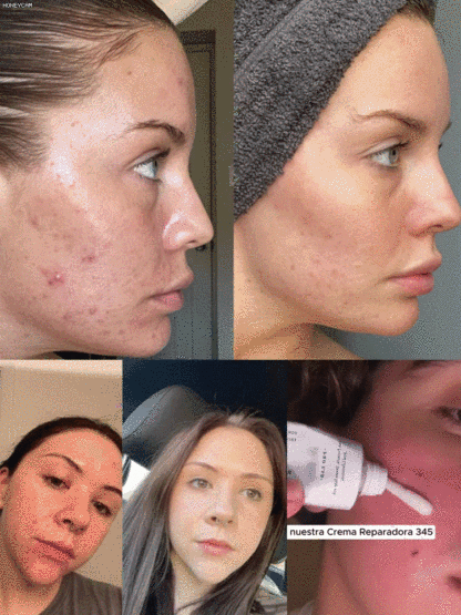  Hydrating and Nourishing Face Cream 345 💎Fades Spots. Restores Glow.