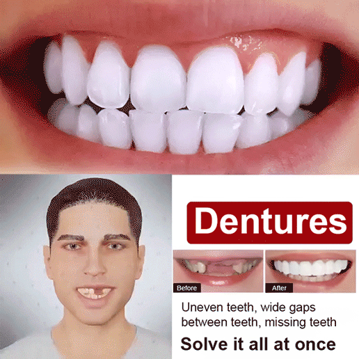 🦷Perfect Smile Denture Set, give you white and neat teeth in 1 second, increase your confidence 100 times🤩