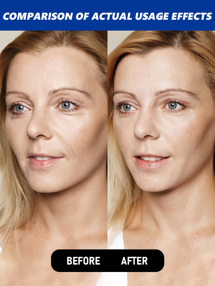 🤩Active Peptide Collagen Transdermal Anti-Wrinkle Cream 💫, reduces forehead wrinkles in 7 days, minimizes eye wrinkles in 14 days💖