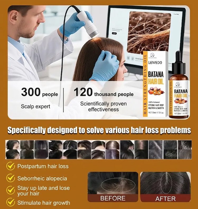 Batana Hair Growth Oil - Natural Hair Thickening & Follicle Care Formula