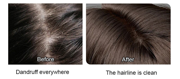 Batana Hair Growth Oil - Nourishing Hair Strengthening & Smooth Shine Formula