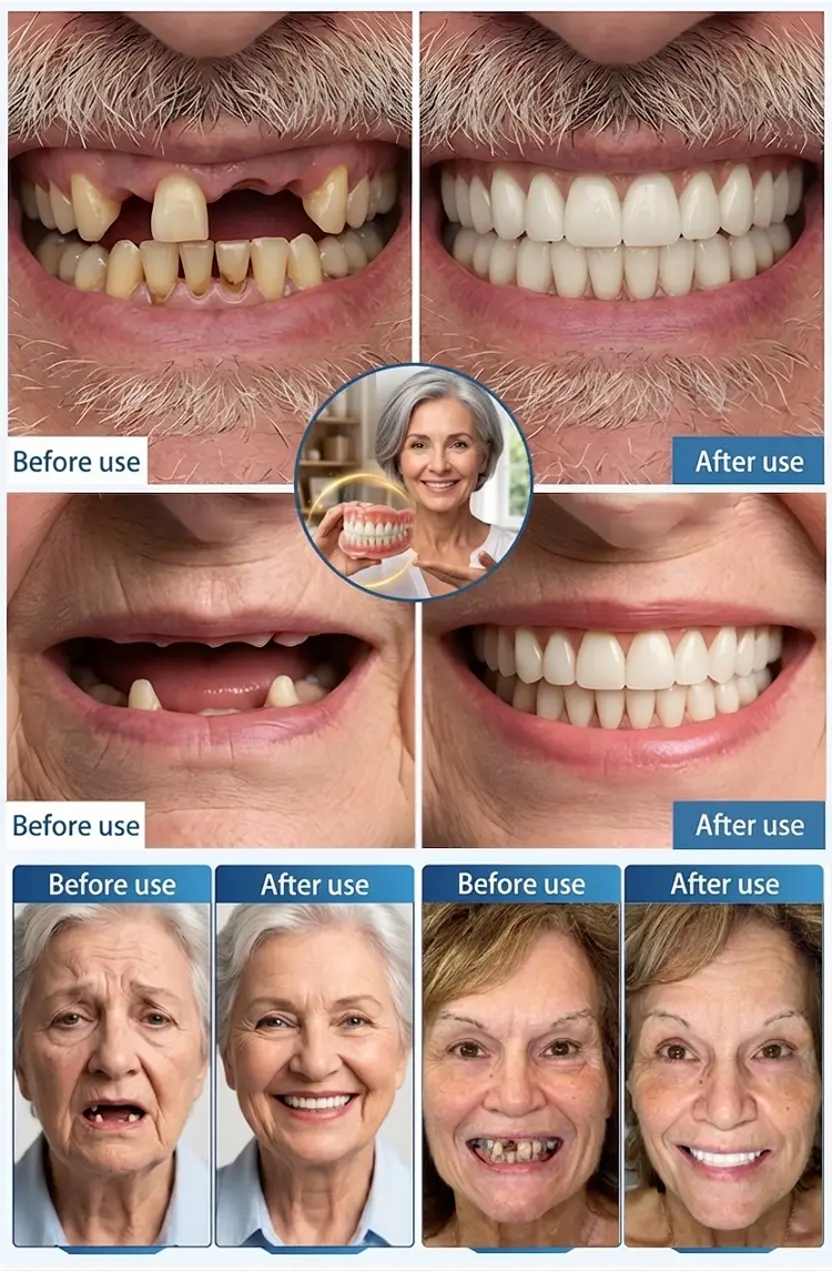Custom-Fit Whitening Braces - Hot Water Molding & Medical-Grade Materials