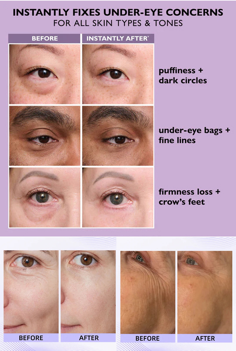 Multi-Effect Anti-Wrinkle Stick - Skin Renewal, Fine Line Repair & Firming Treatment