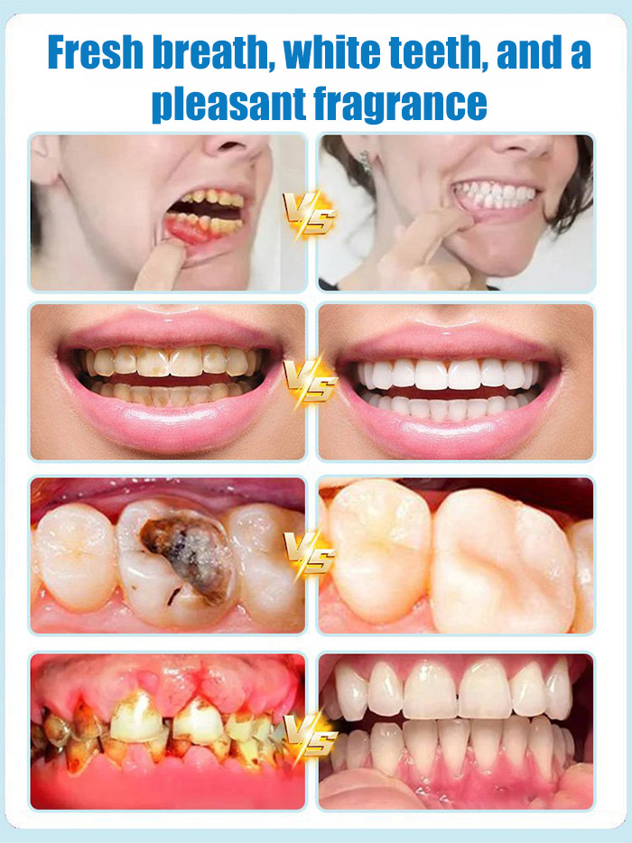 1 brush = instant whiteness ✨! Gentle & delicate formula, enamel-safe 🦷, no heavy feeling during use