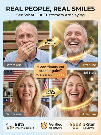 🦷 Direct from the lab: Professional-grade denture kit, instantly regain a natural and perfect smile. Save thousands in exorbitant clinic fees.